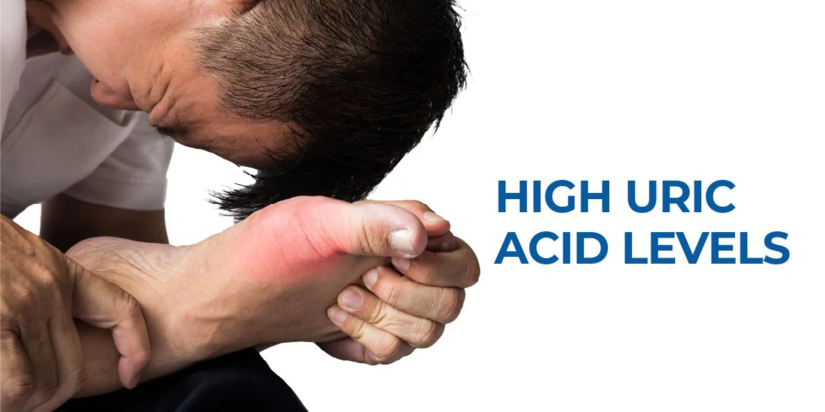 High Uric Acid